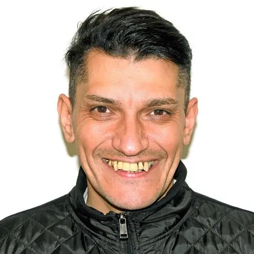 До - Имплантация All-on-4